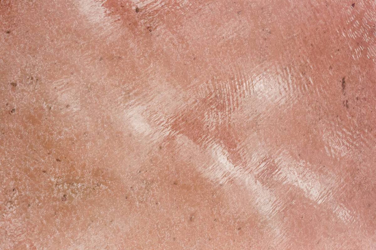 Bridal Makeup for Rosacea: Flawless, Calm & Camera-Ready on Your Big Day