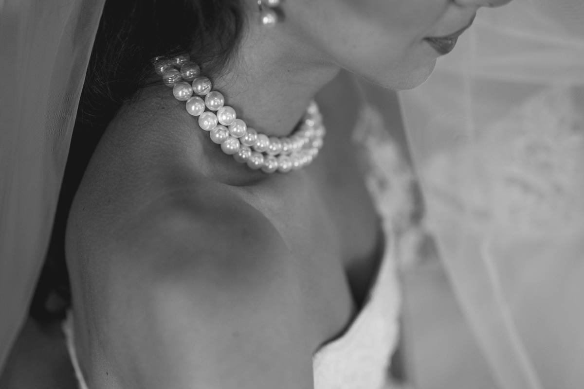 Bridal Makeup for Scars: How to Achieve Flawless, Confident Wedding Day Skin