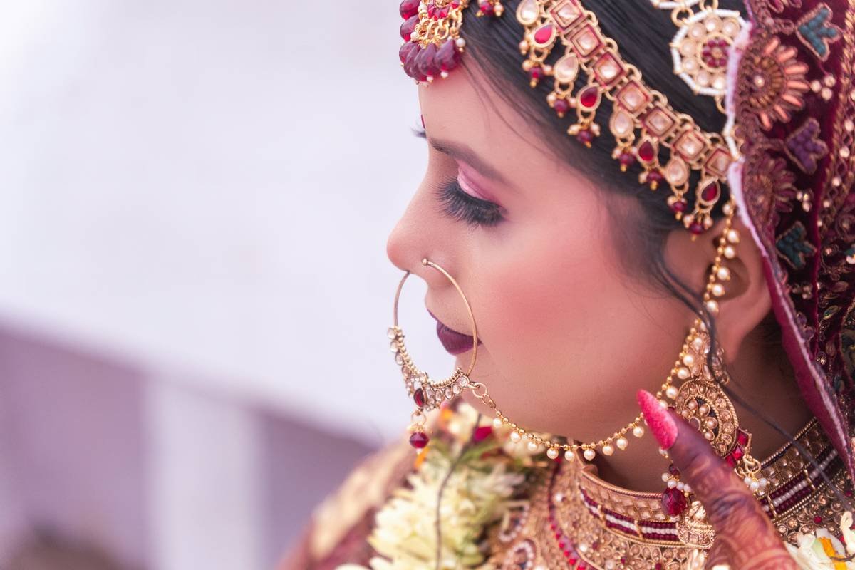 Diagram showing anatomy of under-eye area with labels for thin skin, blood vessels, and shadow zones causing dark circles in brides